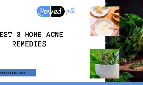 BEST 3 HOME ACNE REMEDIES